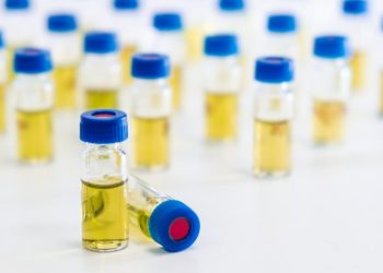 Dikkat! İdrarda köpürme proteinüri habercisi olabilir