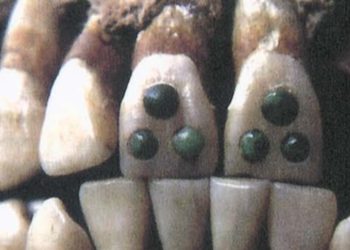 Araştırma: Antik Mayalar dişlerine pahalı taşlarla dolgu yapıyorlardı
