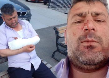 İETT otobüs sürücüsünü bu defa de motosiklet şoförü bıçakladı