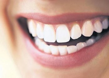 İngiliz sosyetesi ‘diş’ için geliyor