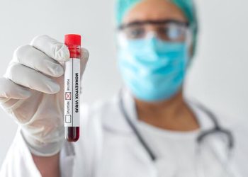 Maymun çiçeği hakkında bilinmesi gereken 5 kıymetli nokta