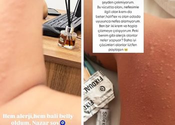 Ünlü müzikçi hastanelik oldu: Bali Belly oldum