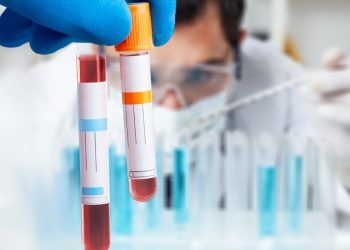 Hatırlamak için yeni umut: Bu test her şeyi değiştirebilir!