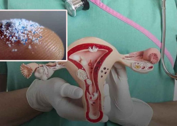 Kadınların yumurtalıklarından alınan sıvıda mililitre başına binlerce mikroplastik parçacığı bulundu