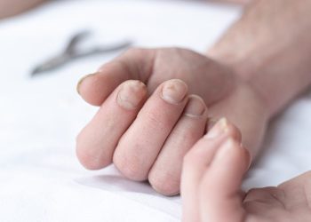 Tırnağınızdaki işaret az hastalığa yakalanacağınız manasına geliyor