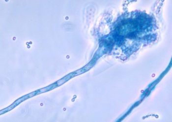 Avrupa ve Asya tehlikede! Ölümcül mantar hastalığı küresel ısınma ile yayılıyor